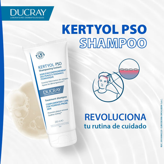 DUCRAY KERTYOL PSO Shampoo para Cuero Cabelludo con Psoriasis