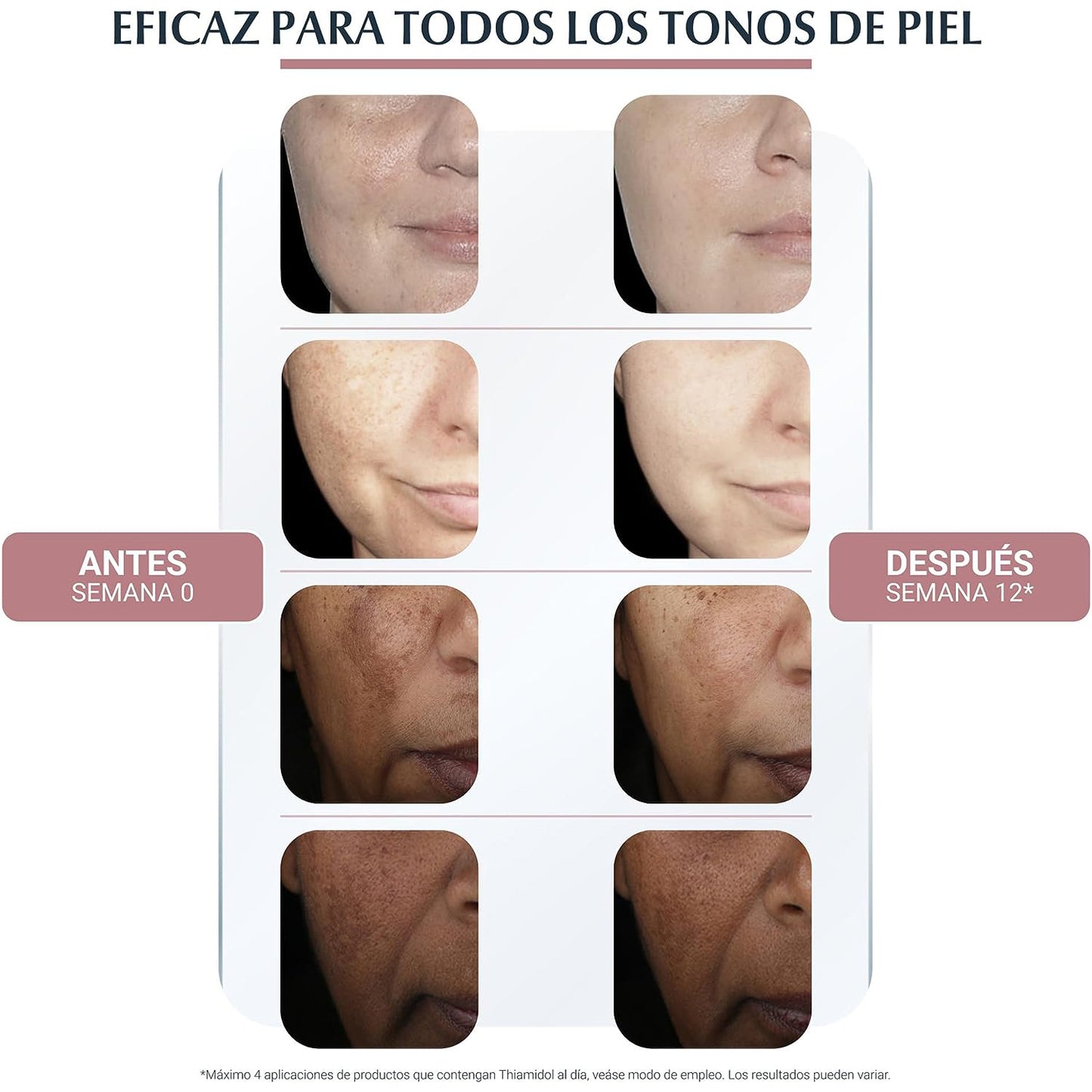 EUCERIN Anti-Pigment Crema Facial De Día Anti-Manchas FPS 30, 50ml