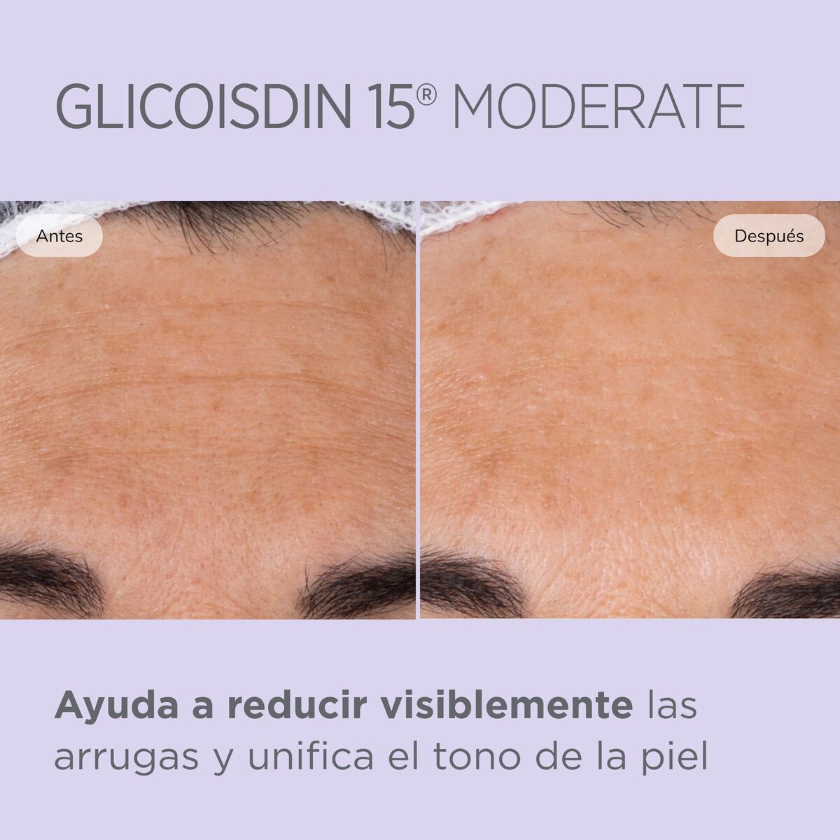 ISDIN Isdinceutics Glicoisdin 10 Soft Gel, Ácido Glicólico, Efecto Peeling, 50ml