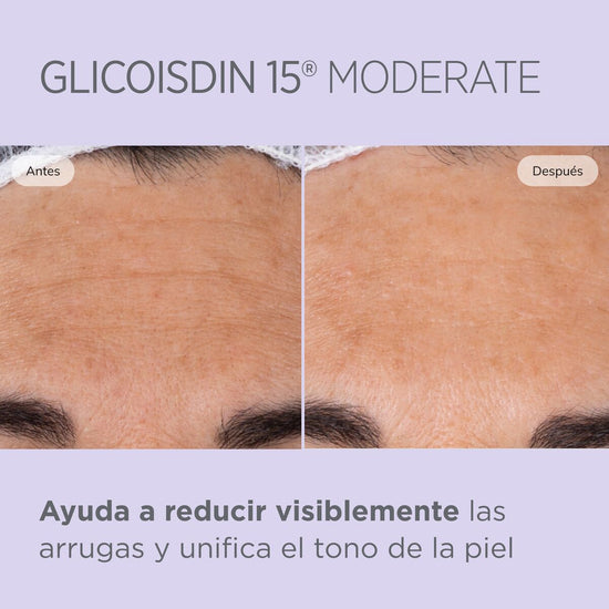 ISDIN Isdinceutics Glicoisdin 10 Soft Gel, Ácido Glicólico, Efecto Peeling, 50ml